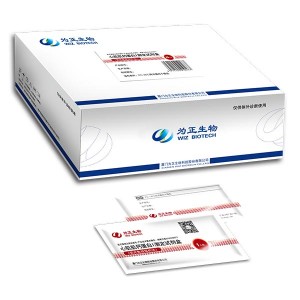 OEM/ODM Manufacturer Rapid Diagnostic Kits For Fob -<br />
 Diagnostic Kit for Hepatitis C Virus Antibody  (Fluorescence Immunochromatographic Assay) - Baysen