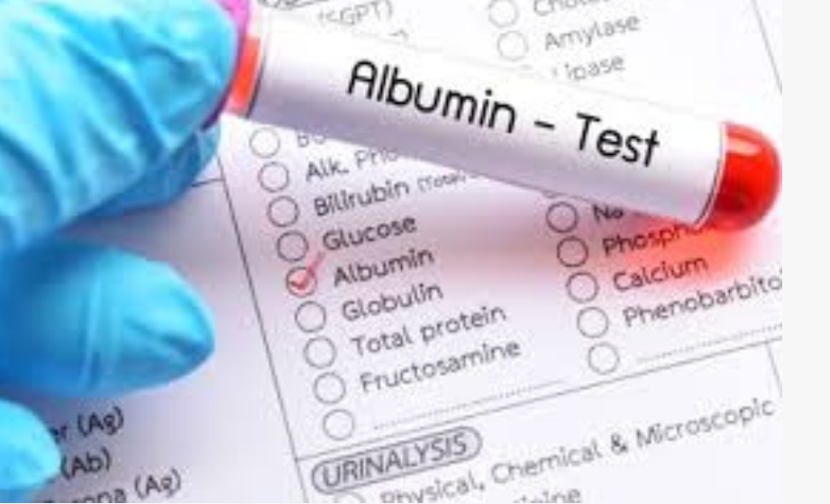 Breakthrough in Early Kidney Disease Detection: The Growing Importance of Urinary Albumin (ALB) Testing
