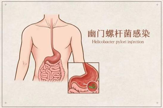 Understanding the H. pylori Antibody Test: What a Positive Result Really Mean