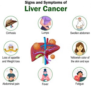 Signs-and-Symptoms-of-Liver-Cancer-1536x1536
