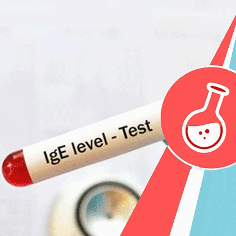 How Total IgE Testing Identifies Allergy Triggers ？