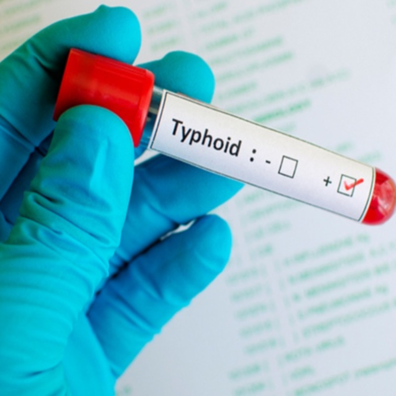 Do you know about Typhoid ?