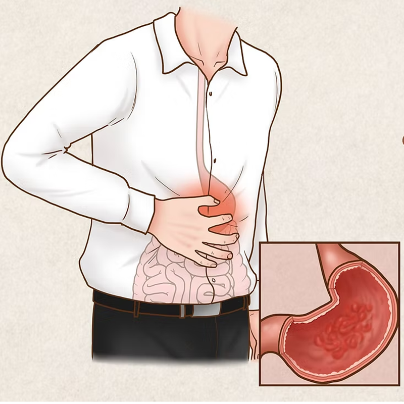 Do you know Biomarkers for Chronic Atrophic Gastritis?